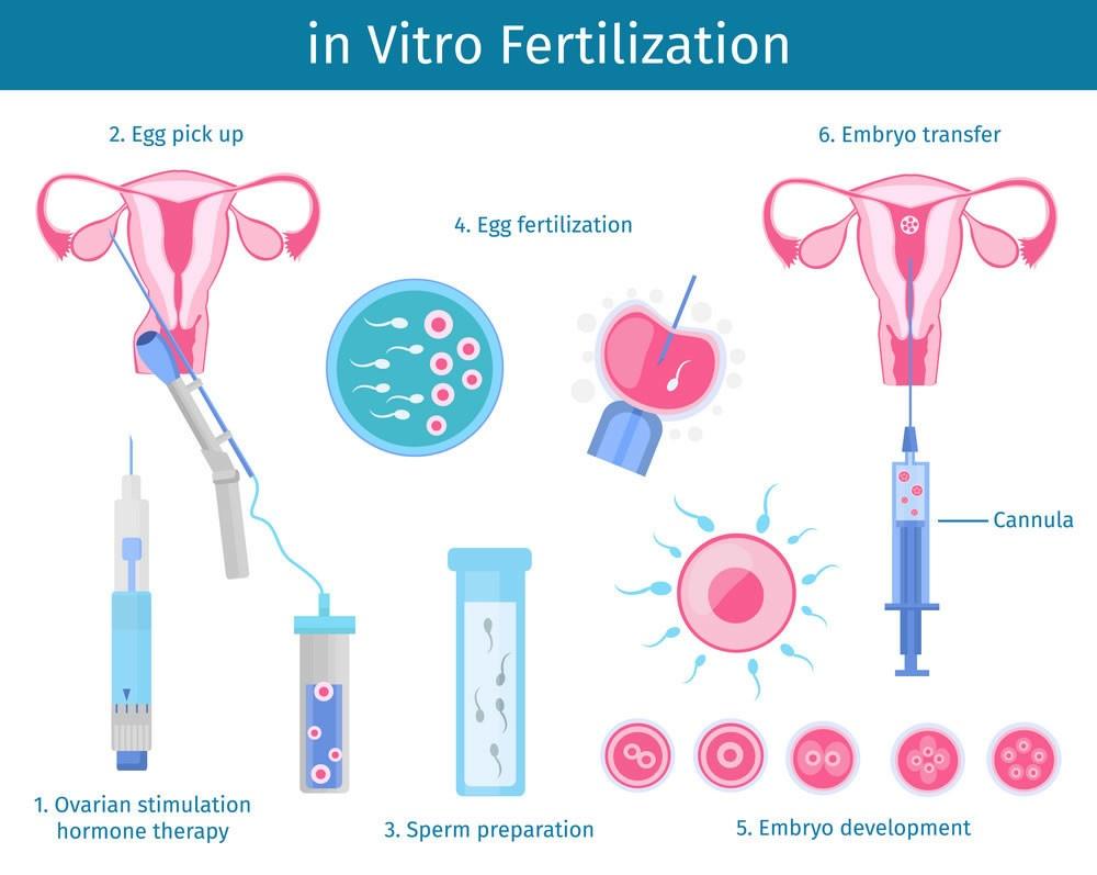 ivf process