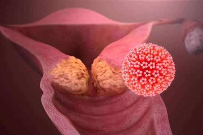Μπορεί ο ιός HPV να Επηρεάσει τη Γονιμότητα;